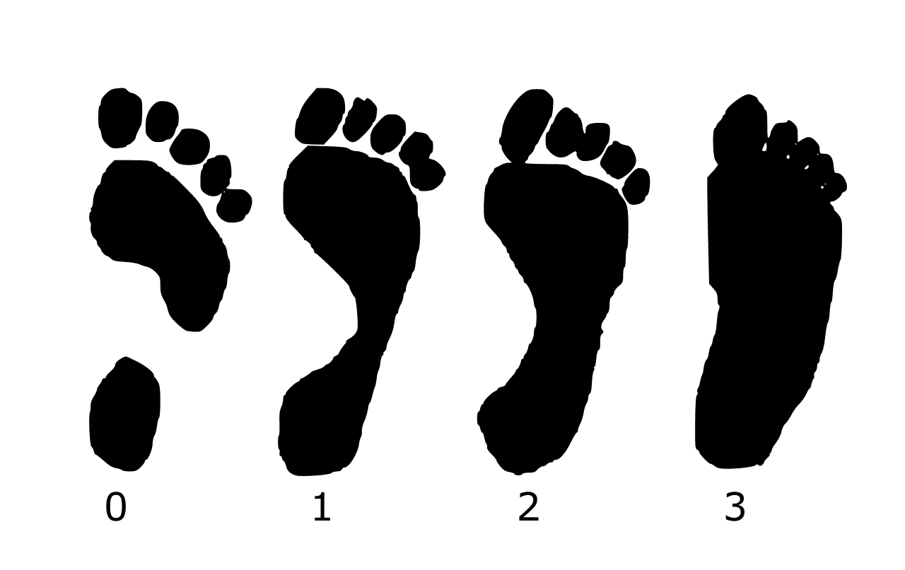 Diagram comparing a flat-foot footprint with an arched footprint
