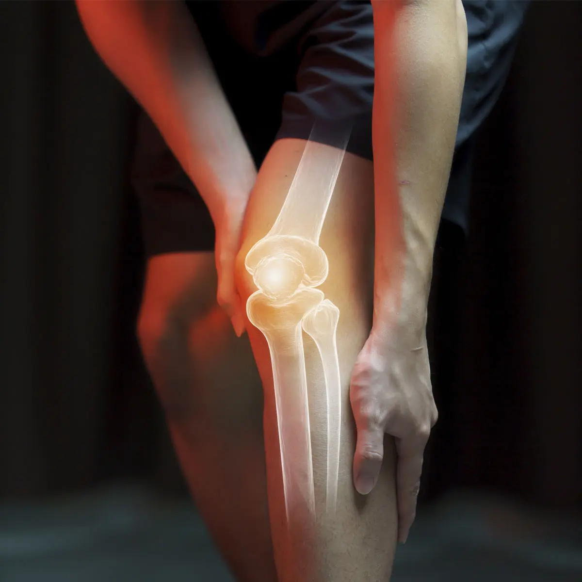 خشونة الركبة | Knee Osteoarthritis