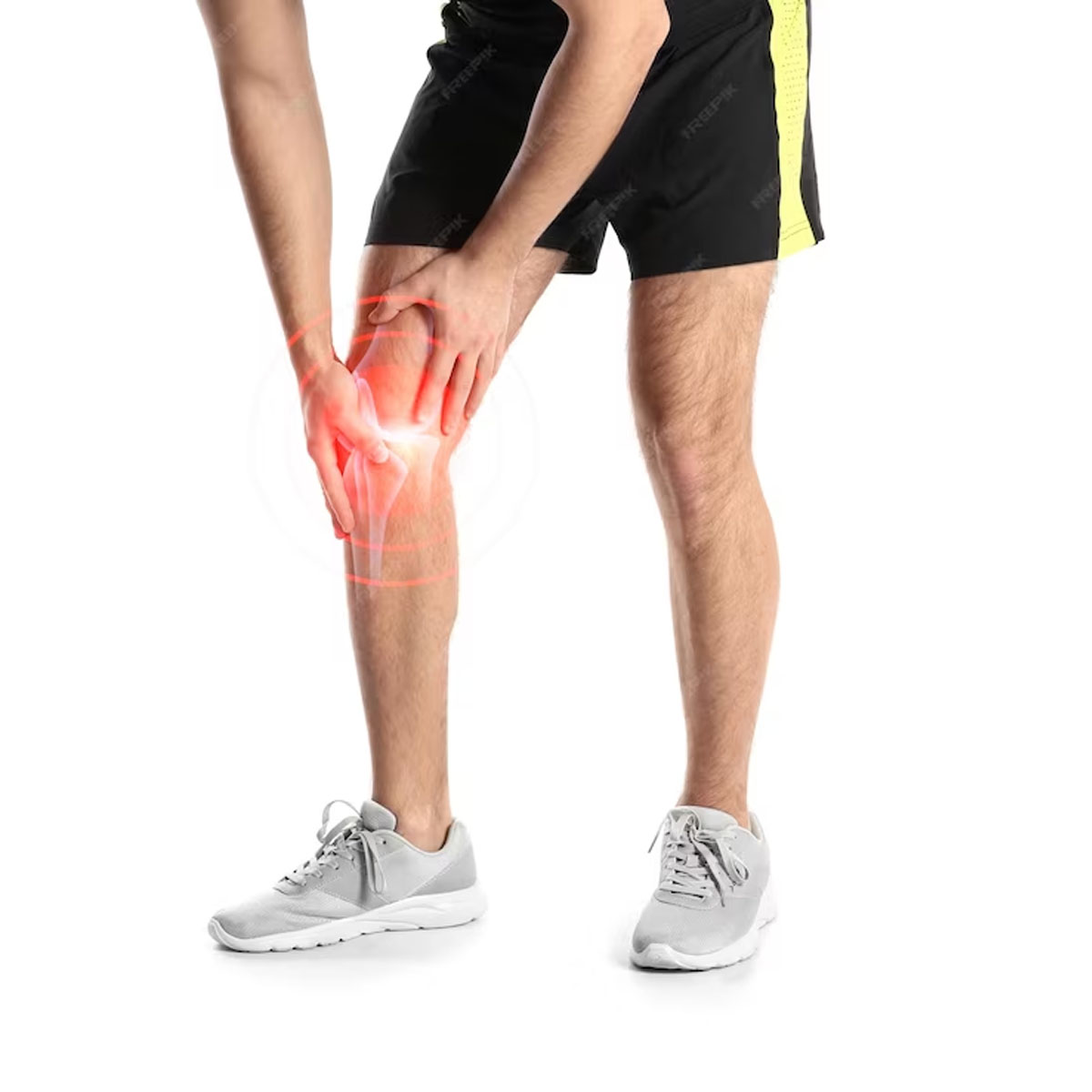 إصابة الرباط الجانبي الأنسي (MCL) | Medial Collateral Ligament (MCL) Injury