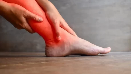 التواء الكاحل